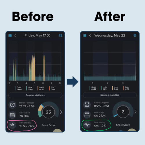 Snoregrip Pro (Official Retailer) 2026