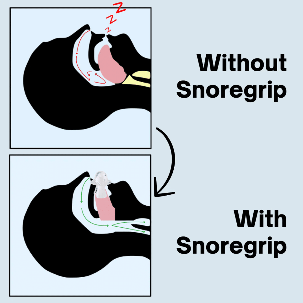 Snoregrip Pro (Official Retailer) 2026
